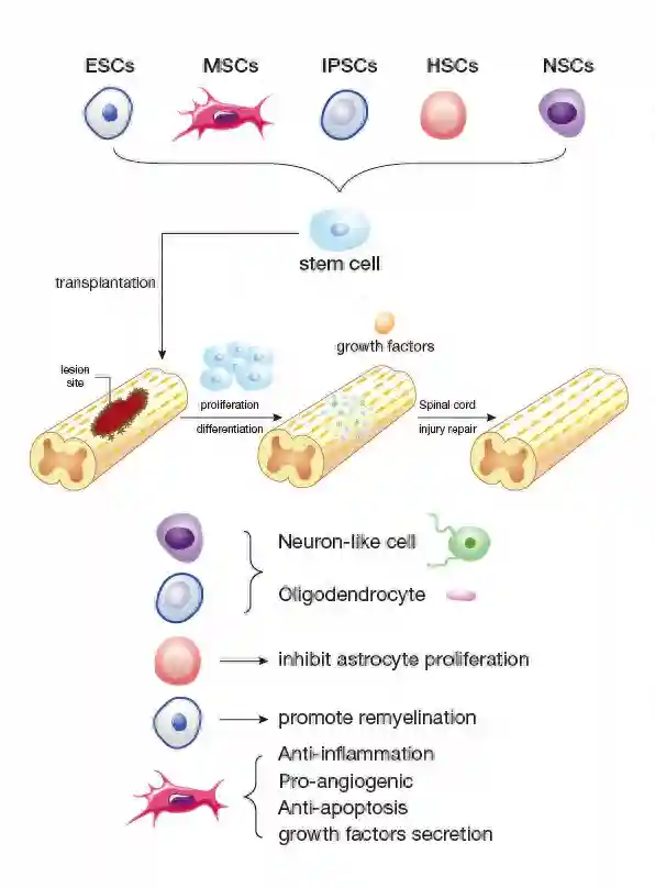 南通大学董传明团队阐述利用干细胞联合三维生物打印支架治疗脊髓损伤的现状